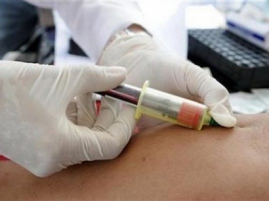 Peste 200 de mii de persoane afectate de HIV, asistate de centrele Baylor